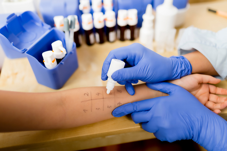 Does Your Child Need an Allergy Skin Test?